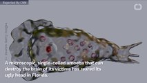 Brain-Eating Amoeba Shows Up In Florida