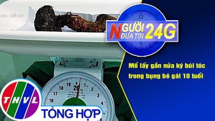 Người đưa tin 24G (6g30 ngày 5/7/2020): Mổ lấy gần nửa ký búi tóc trong bụng bé gái 10 tuổi