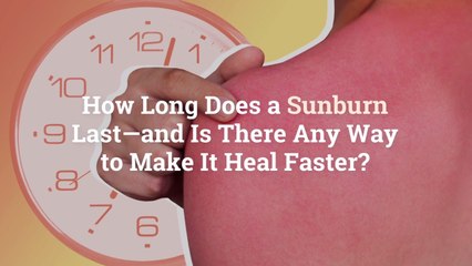 How Long Does a Sunburn Last—and Is There Any Way to Make It Heal Faster?