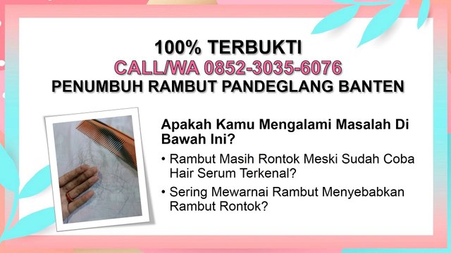 LUAR BIASA AMPUH, CALL/WA 0852-3035-6076, Obat Penumbuh Rambut Rontok Pandeglang Banten