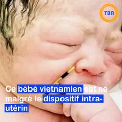 Un bébé tient le stérilet de sa maman après sa naissance