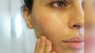 Tips For Glowing Skin: नमक से  पाएं चेहरे पर चमक,1 दिन में हटाएं दाग-धब्बे । Salt For Skin । Boldsky