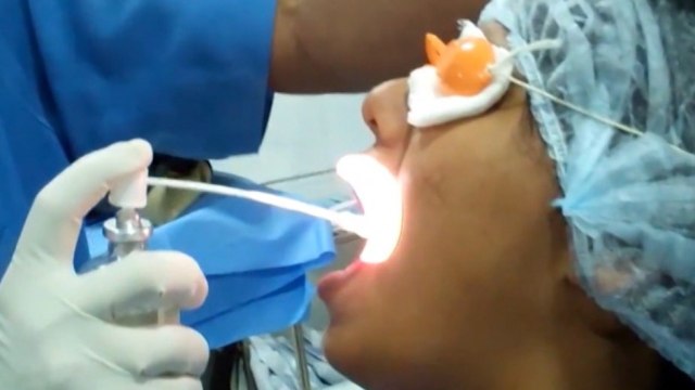 bd-porque-hay-mal-aliento-a-pesar-del-lavado-de-dientes-090720