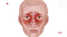 7pa5 - Pse ndodh hemoragjia nga hundet dhe si ta ndaloni – 3 Korrik 2020 – Vizion Plus
