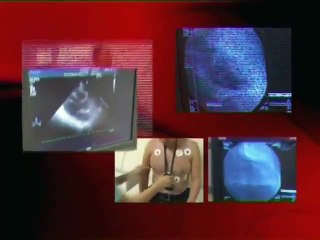 Örnek Vaka - 68 Yaşında Erkek Hasta Kalp Krizi