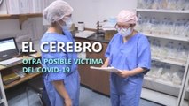 Pacientes de COVID-19 podrían sufrir afectaciones cerebrales