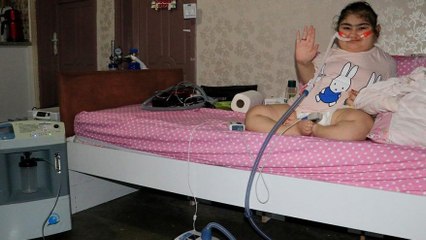 Cam kemik hastası Yasemin evden çıkamıyor