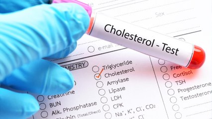 Protein In "Good Cholesterol" May Lower Dementia Risk