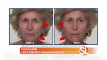 Try Plexaderm to reduce sagging skin and puffy eye bags