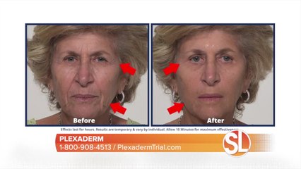 Try Plexaderm to reduce sagging skin and puffy eye bags