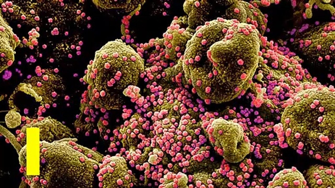 First COVID-19 vaccine tested in U.S. shows promising results