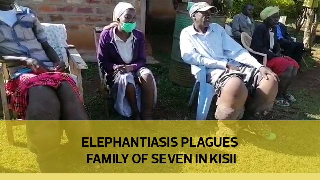 Elephantiasis plagues family of seven in Kisii
