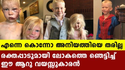 Bridger walker the viral brave boy | Oneindia Malayalam