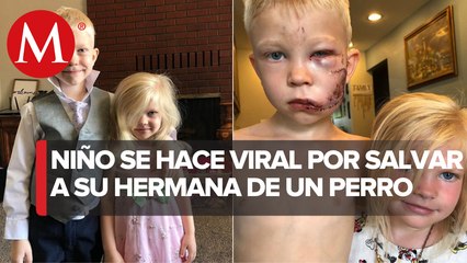 Niño de 6 años se convierte en héroe; salva a su hermanita de ser asesinada por un perro