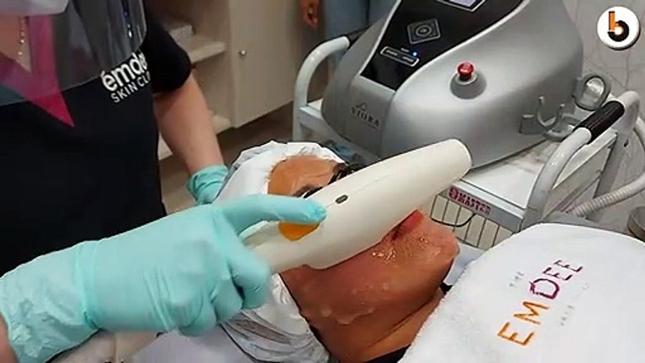 BAHAYA TERLALU LAMA PAKAI MASKER BISA SEBABKAN INI