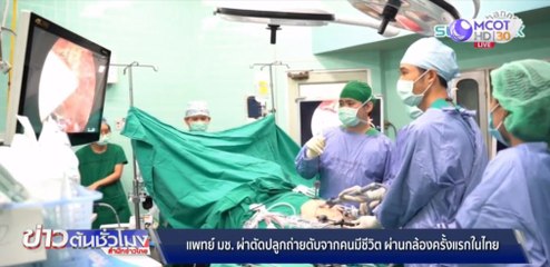 แพทย์ มช.ผ่าตัดปลูกถ่ายตับจากคนมีชีวิต ผ่านกล้องครั้งแรกในไทย