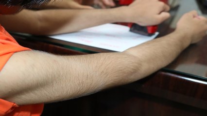 Mắc bệnh lạ, bé gái mọc lông khắp cơ thể | VTC