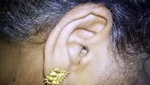 Must Watch This> Spider Crawls out from a woman ears.