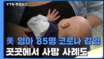 美 텍사스서 영아 85명 코로나19 감염...브라질, 사망 사례도 잇따라 / YTN