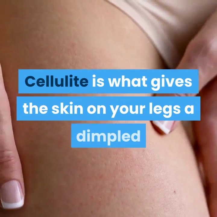 7-great-exercises-to-combat-cellulite