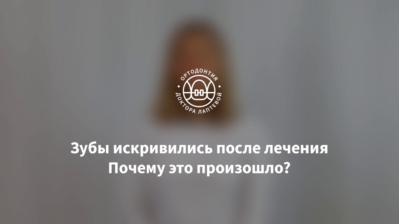 Зубы разъехались после брекетов? Ретейнеры, капы.