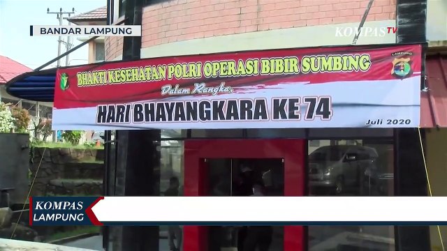 Sambut Hari Anak Nasional, Polda Lampung Gelar Baksos Operasi Bibir Sumbing