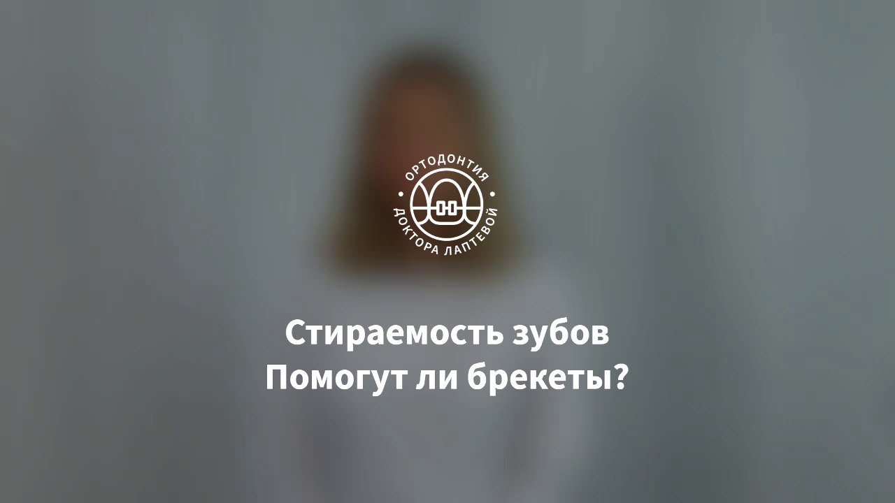 Зубы стираются! Брекеты помогут!?