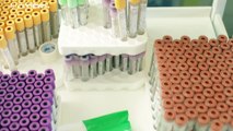 1000 Freiwillige testen Coronavirus-Impfstoff