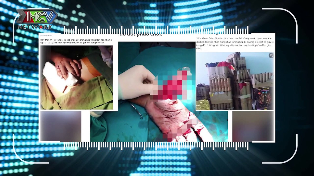CAMERA CẬN CẢNH | Tập 343: Đeo Khẩu Trang Là Bảo Vệ Chính Mình