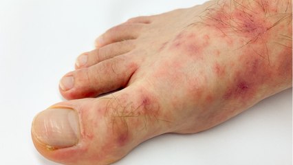 The Very Nasty Ways COVID-19 Can Attack The Body Even After 'Recovery'