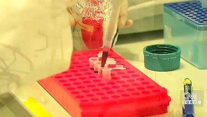 Sinsi hastalık: Parkinson... Hasta sayısı 18 milyona ulaşacak | Video