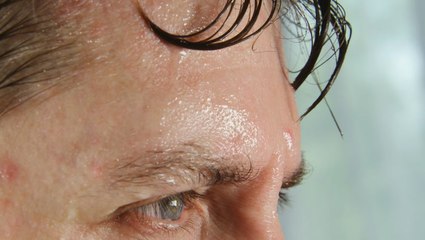 Diagnosing a heat-related illness