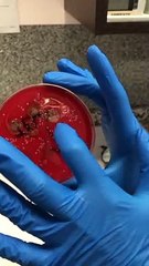 Esto es lo que ocurre cuando usas tu mascarilla más tiempo del recomendado