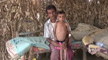 2,5 millones de niños, en riesgo de morir de hambre en Yemen