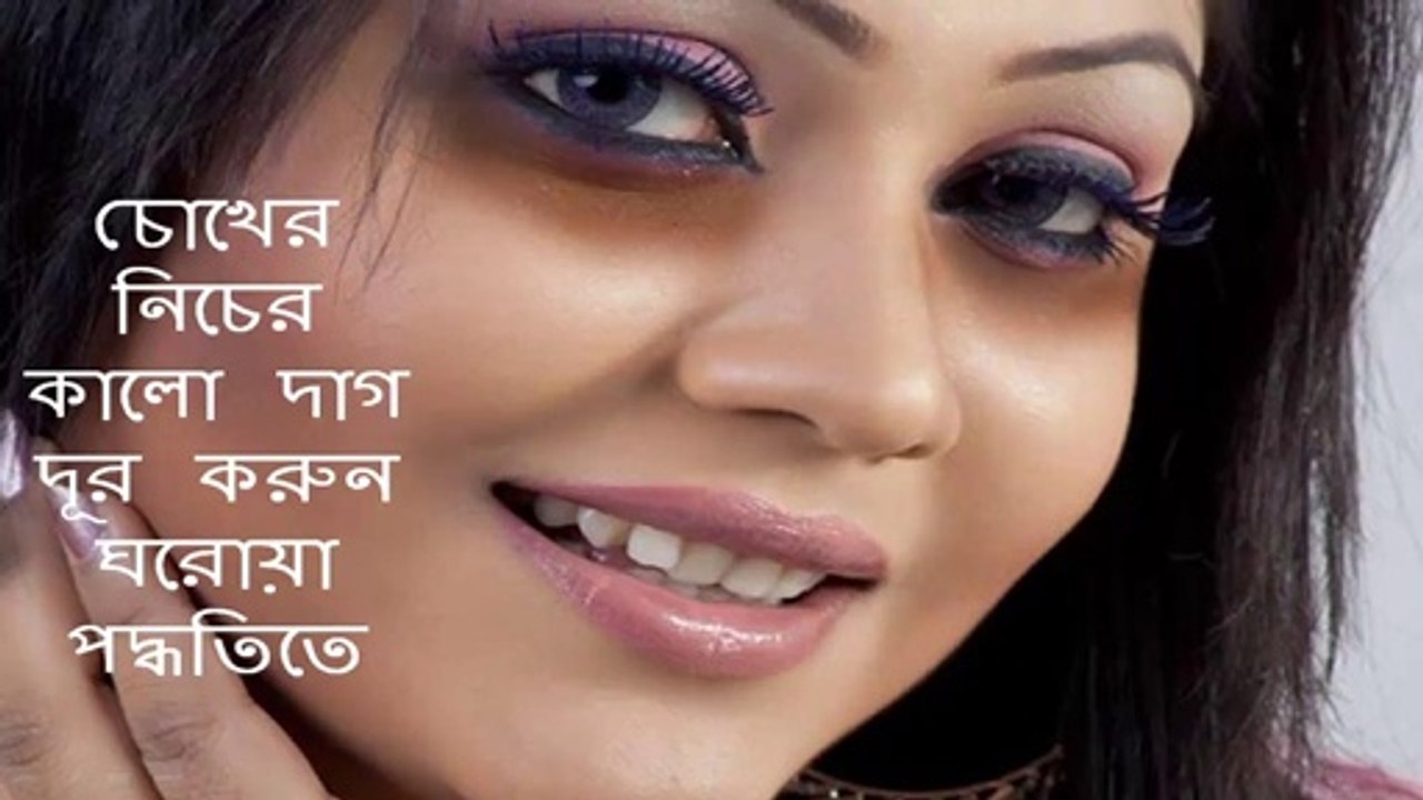 How to Remove black spots in the eye ।। dark circles ।। beauty tips