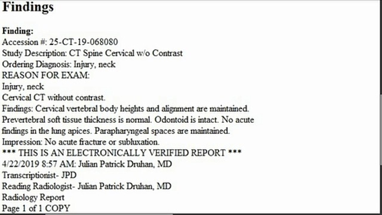 Radiologist Julian Patrick Druhan MD Misdiagnosed My St. Vincent's CT /X-Ray Images