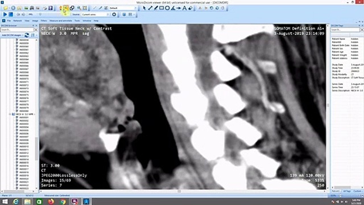 Doubt Cast On Parasite Infection Northside Medical St. Vincents Primary Trussville