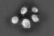 La historia del primer coronavirus humano