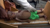 شبح المجاعة يطل على اليمن من جديد