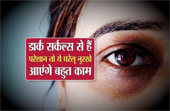 डार्क सर्कल्स से हैं परेशान तो ये घरेलू नुस्खे आएंगे बहुत काम