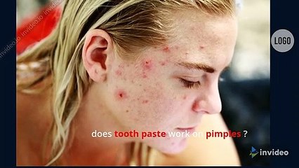 does toothpaste remove pimples