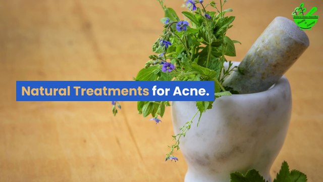 How To Get Ride Of Acne Scars : Just Few Days How to prevent and Quickly Remove Acne