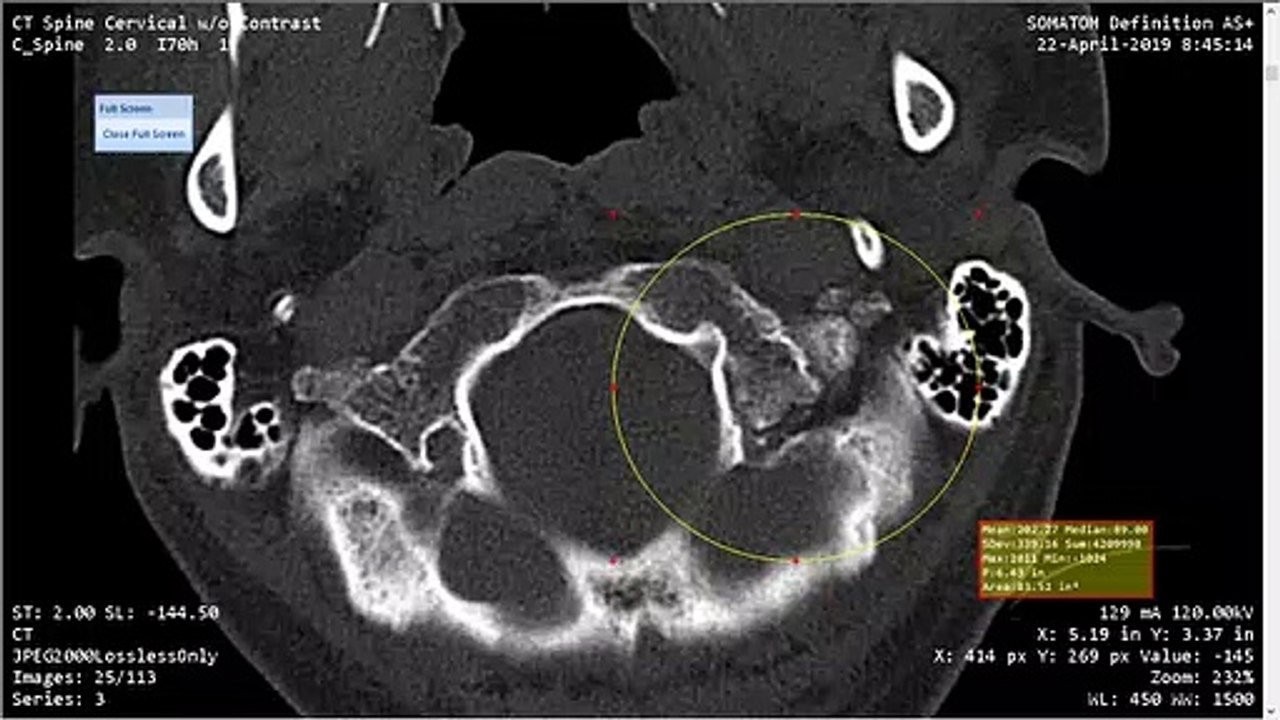 Is My Injury Being Used For Research?
