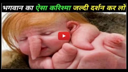 5 ऐसे बच्चे जिनके साथ भगवान ने नाइंसाफी की देखकर रो पड़ोगे 10 Most Unusual Kids In The World
