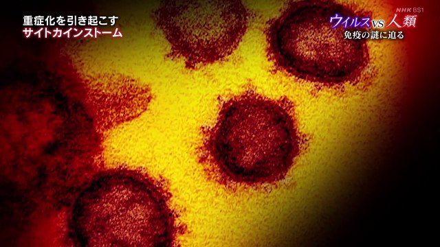 ＢＳ１スペシャル「ウイルスＶＳ人類４　新型コロナ　免疫の謎に迫る」ワクチンや治療薬の開発など収束のカギを握る免疫システム。だが新型ウイルスでは謎だらけ。抗体検査など最新の知見も踏まえ、専門家が徹底討論。免疫力アップの秘けつとは　2020年7月18日