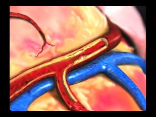 Keep Your Heart Healthy 2