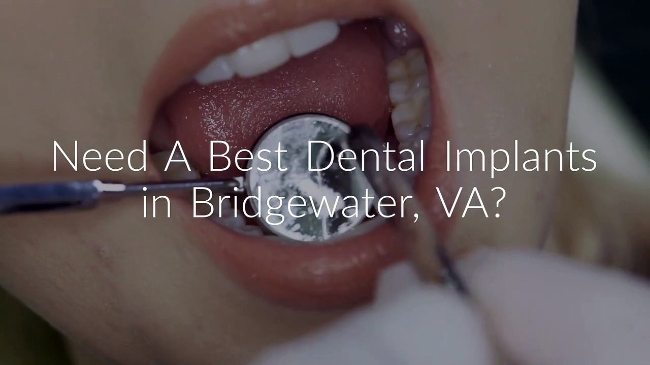 Smiles For Life Dental Implants in Bridgewater, VA video Dailymotion