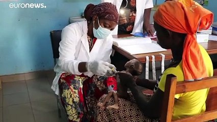 ONU alerta para desnutrição crónica agravada pela pandemia