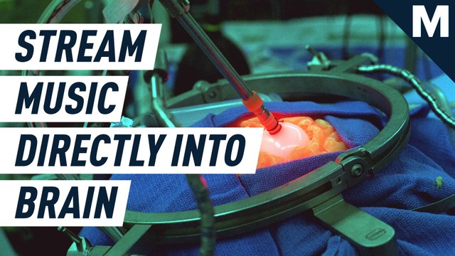 Elon Musk wants to unite the human brain with AI using a tiny implant