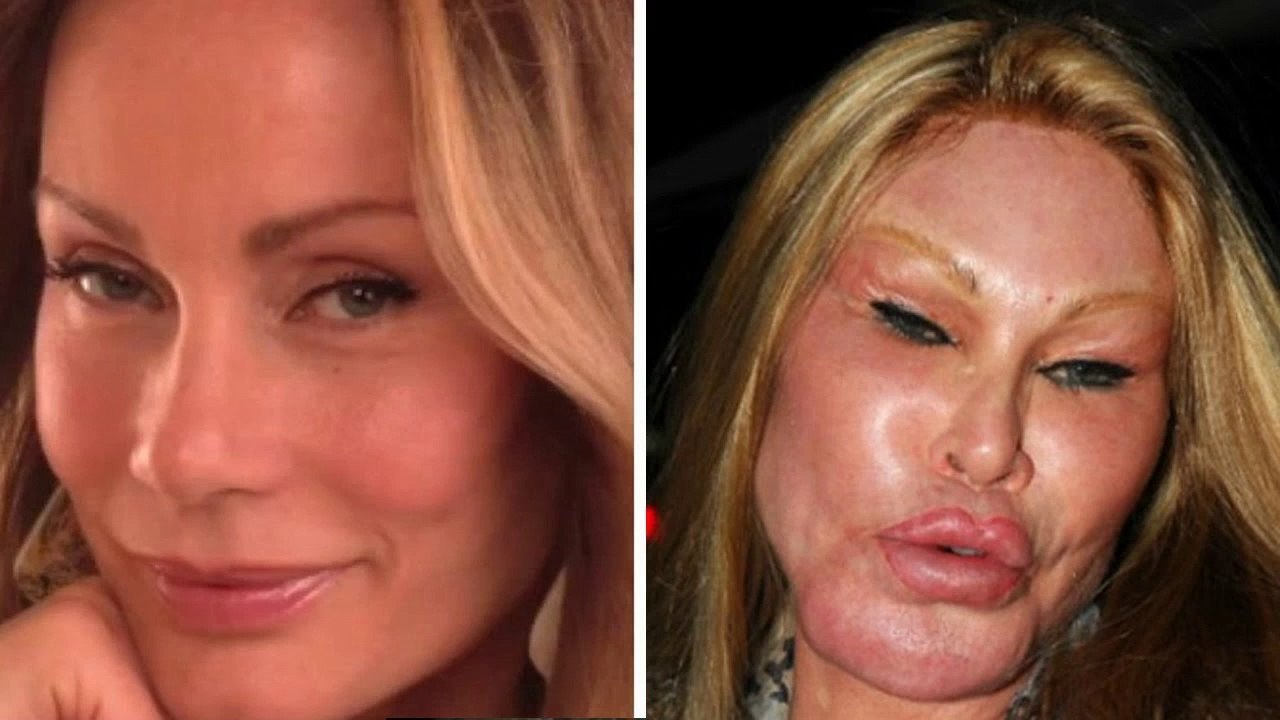 9 People Who Took Plastic Surgery Way Too Far